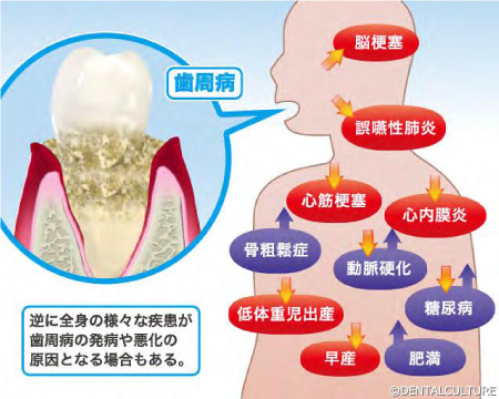 全身疾患との関係